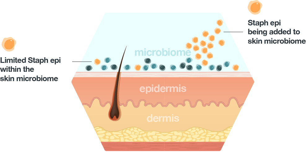 Taming Staphylococcus aureus in the eczema skin microbiome